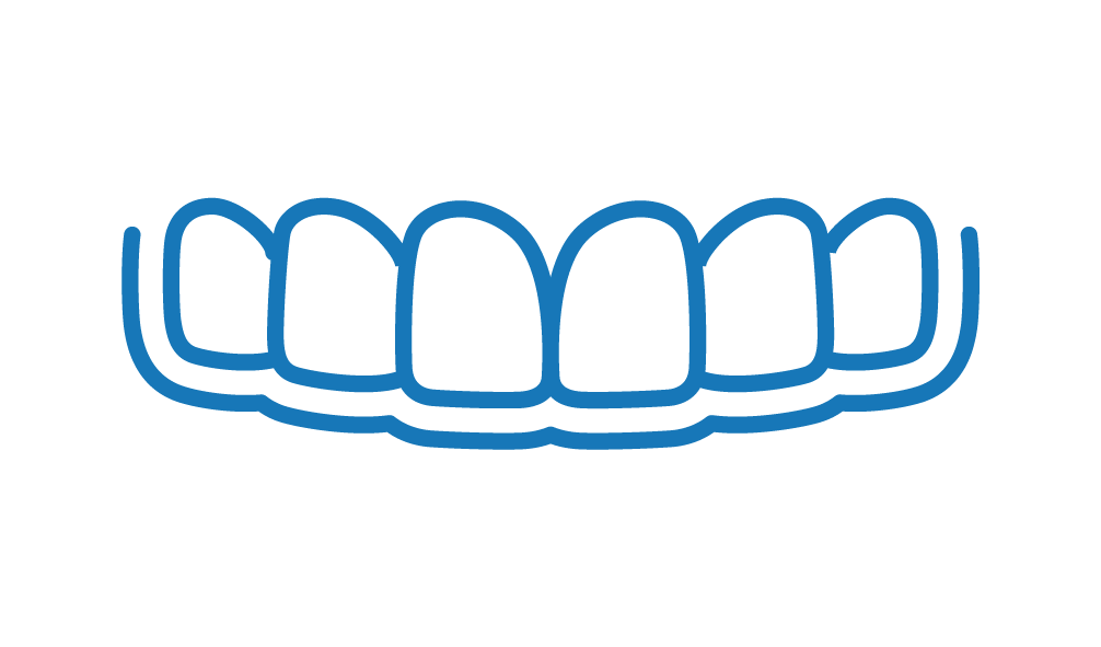 Clear Aligners (Invisible Braces)